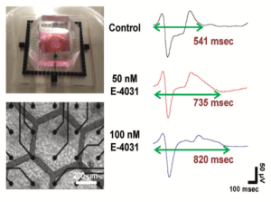 Electric physiology measurement